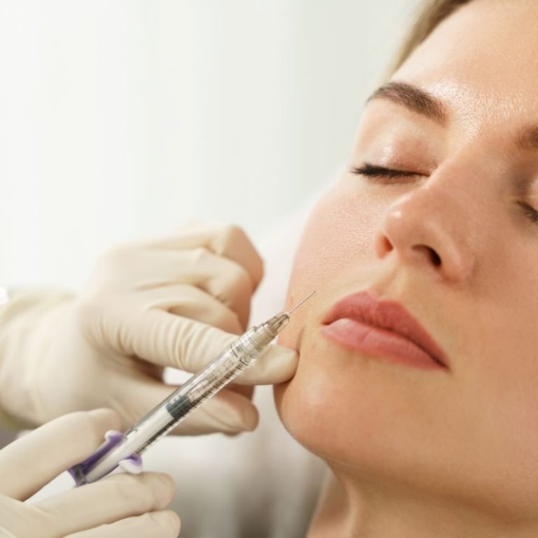 dermal fillers 1